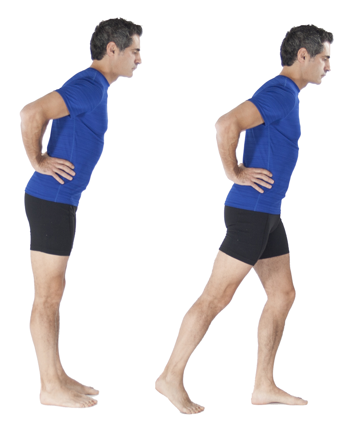 站立髋屈曲矫正关节稳定性